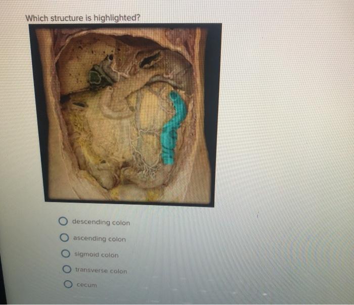 Which structure is highlighted cecum