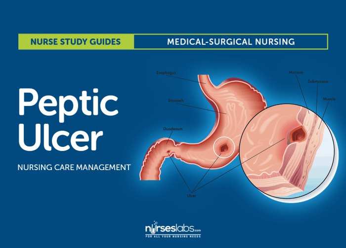 Peptic ulcer disease hesi case study