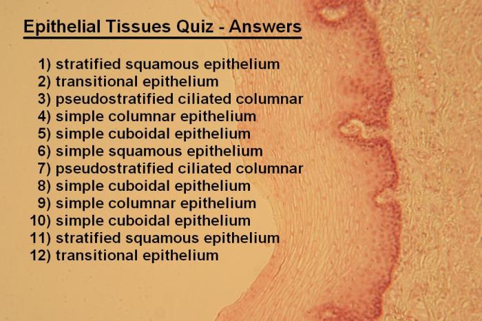 Epithelial tissue and connective tissue quiz